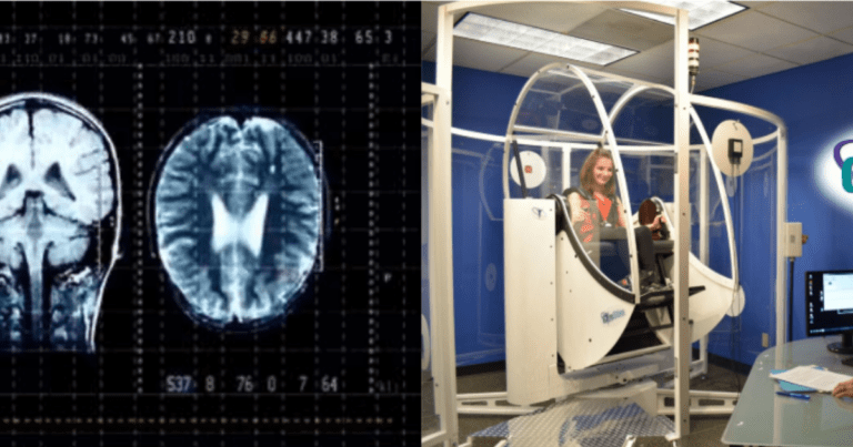 La technologie et les traumatismes cérébraux-crâniens légers